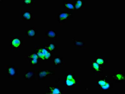 IHC-plus™ Polyclonal Rabbit anti-Human SOD1 / Cu-Zn SOD Antibody (aa 2-154, IHC, IF, WB)