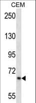 Polyclonal Rabbit anti-Human PMEL / SILV / gp100 Antibody (aa412-440, WB)