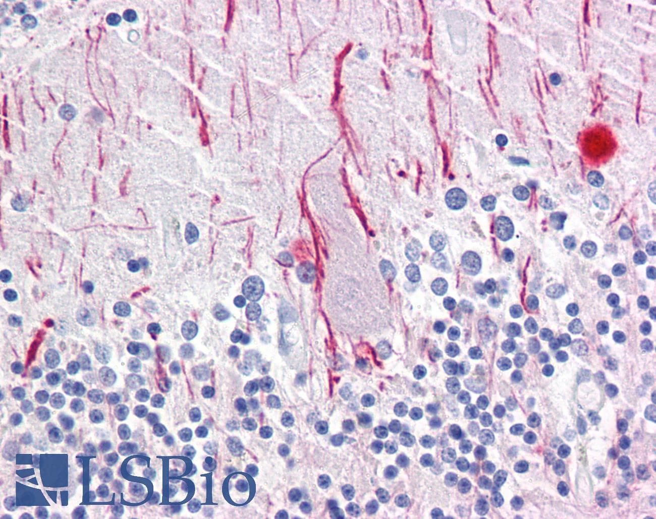 IHC-plus™ NEFH / NF-H Antibody (clone RNF405)