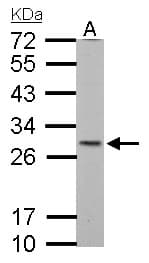 SDHB Antibody (aa221-280)