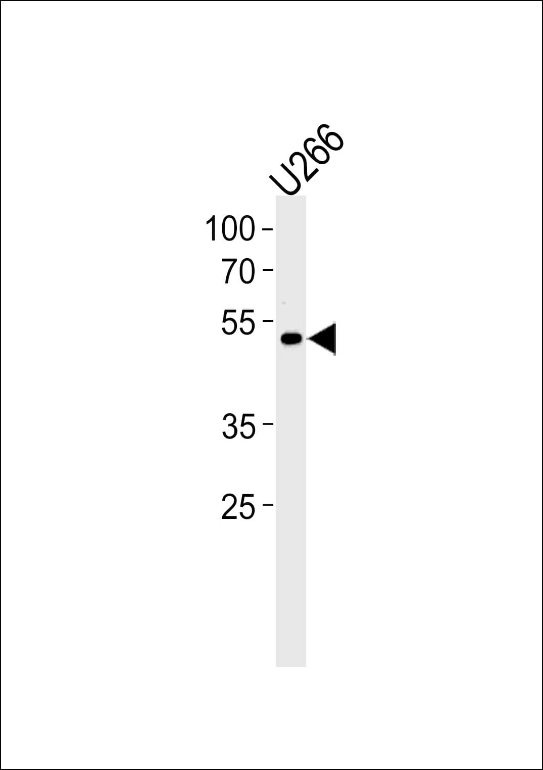 IHC-plus™ Polyclonal Rabbit anti-Human ETV6 / TEL Antibody (aa84-111, IHC, WB)