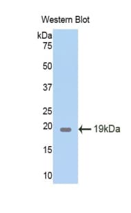 PTN / Pleiotrophin Antibody (aa33-168)