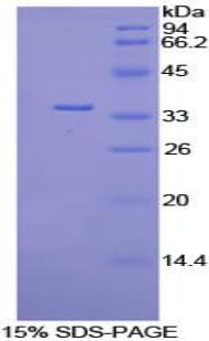 Mouse PDK4 Protein (Recombinant His-T7)