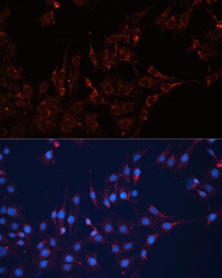 GNAI2 Antibody