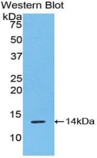 RSPO1 / RSPO Antibody (aa21-135)