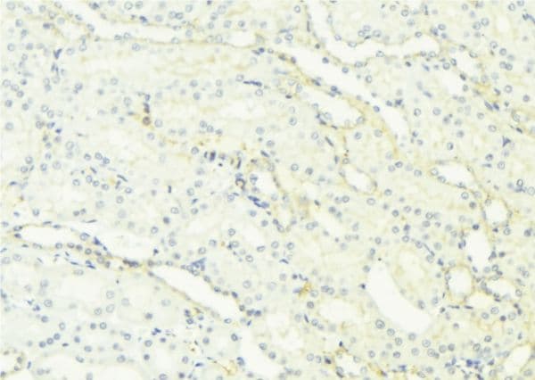 RAB27A / RAB27 Antibody