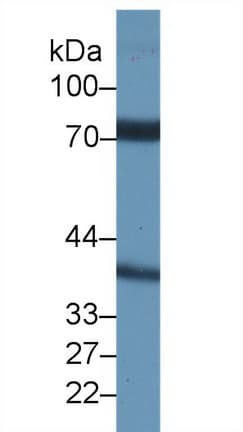 NCSTN / Nicastrin Antibody (aa35-534, PE)