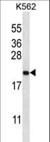 GAGE2B Antibody (aa1-30)