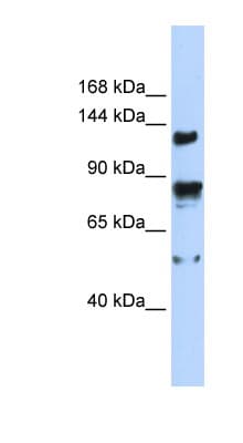 Polyclonal Rabbit anti-Human TRPM4 Antibody (aa359-408, WB)