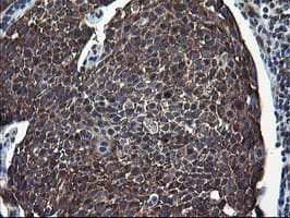 CNOT4 / CLONE243 Antibody (clone OTI1H2)