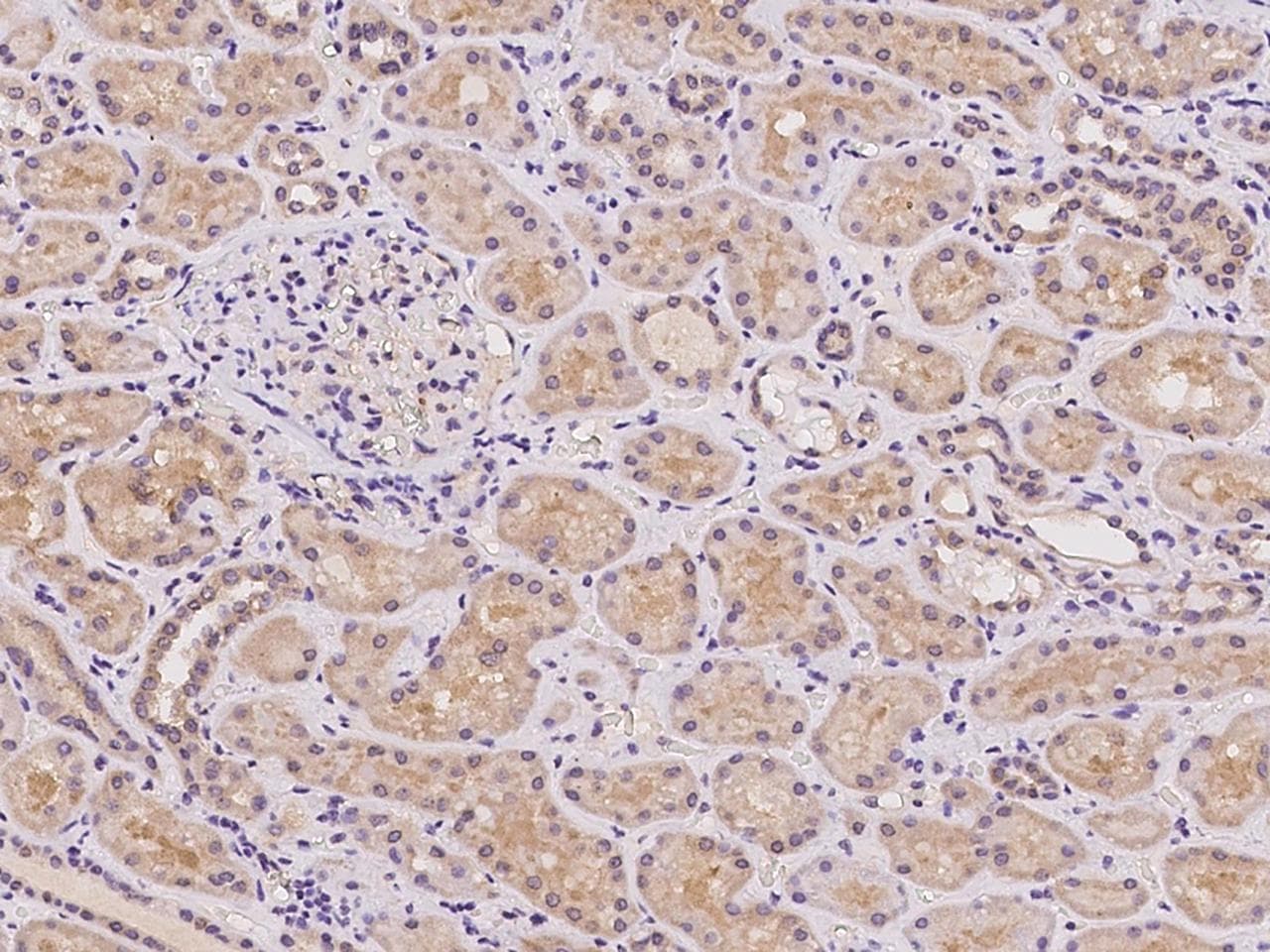AACS Antibody