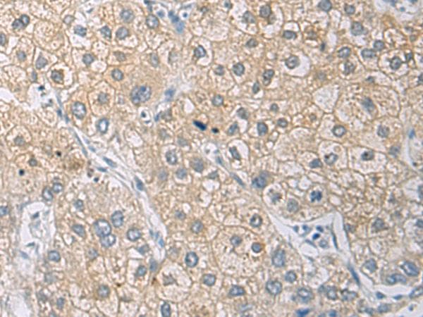 IL1RN Antibody