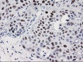 PRKCE / PKC-Epsilon Antibody (clone OTI3A12, Carrier-free)
