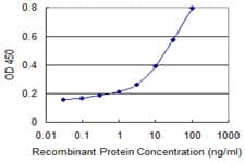 VIL1 / Villin Antibody (clone 3G6)
