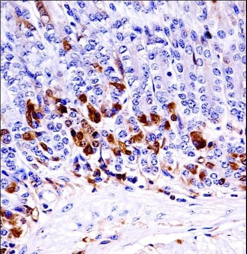 MAP3K6 / MEKK6 Antibody (aa223-252)