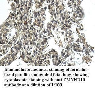 ZMYND10 Antibody (aa161-421)