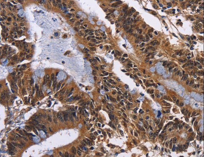 EPHB6 / EPH Receptor B6 Antibody