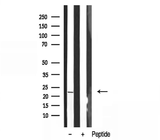 CSRP1 Antibody