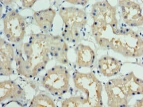 DCUN1D1 / SCCRO Antibody (aa1-259)