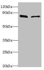 Polyclonal Rabbit anti-Human SLC39A6 / LIV-1 Antibody (aa170-320, IHC, WB)