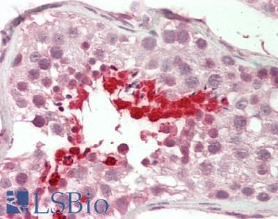 BRDT Antibody (N-Terminus)