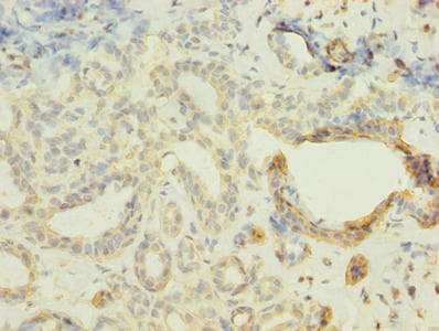 FBXO28 Antibody