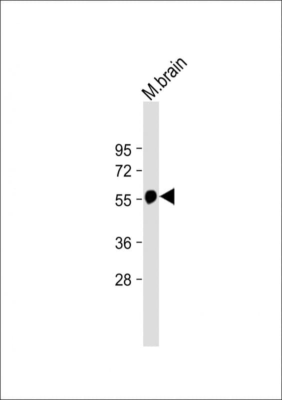 Tubulin beta-5 chain Antibody