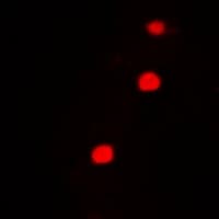 HFip1 / FIP1L1 Antibody