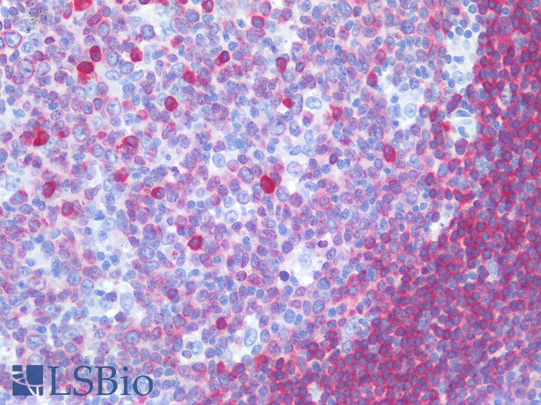 IHC-plus™ CD79A / CD79 Alpha Antibody (aa202-216, clone JCB117 + HM47/A9)