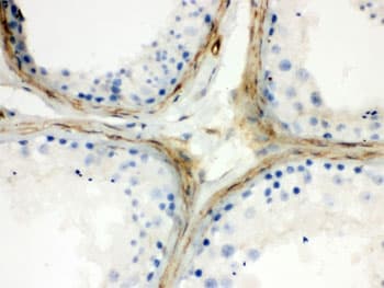CLU / Clusterin Antibody