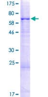 Human CRISPLD2 Protein (Recombinant GST)