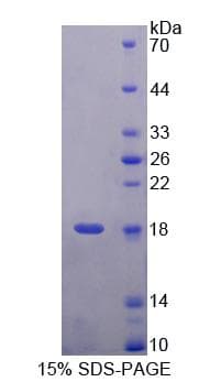 Human UBA52 Protein (Recombinant His-T7)