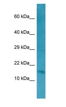 Polyclonal Rabbit anti-Human RFK Antibody (aa48-97, WB)