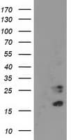IHC-plus™ CDKN3 / KAP Antibody (clone 2E11)