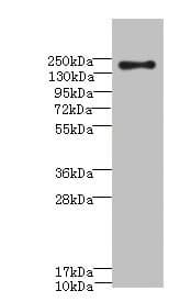Polyclonal Rabbit anti-Human CR1 / CD35 Antibody (aa420-550, IHC, WB)