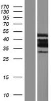 PLSCR4 Protein (Over-Expression Lysate Myc-DDK (Flag))