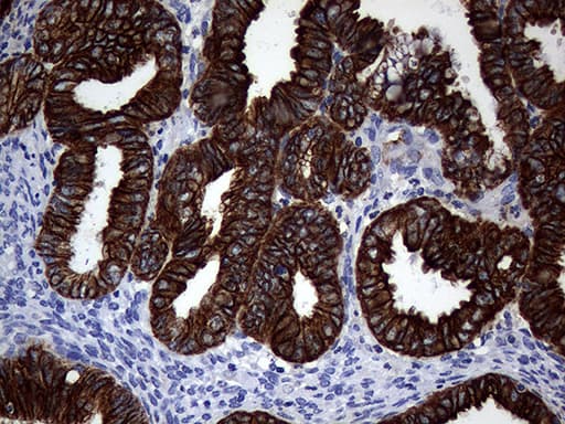 KRT18 / CK18 / Cytokeratin 18 Antibody (aa69-372, clone OTI10H8)