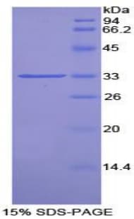 Rat PIM2 / Pim-2 Protein (Recombinant His-T7)
