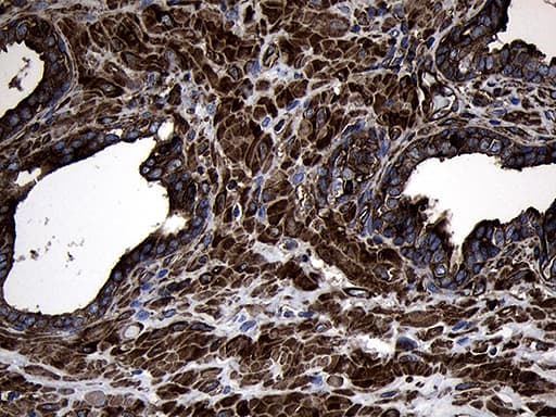 MLC3F / MYL1 Antibody (aa2-150, clone OTI3D1, Carrier-free)