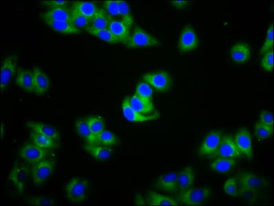 Polyclonal Rabbit anti-Human IGHA2 Antibody (IHC, IF)