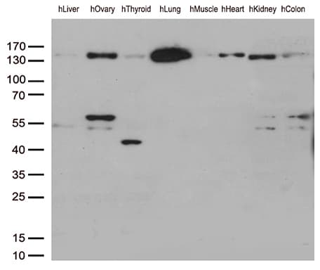 PECAM-1 / CD31 Antibody (clone UMAB32)