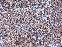 HARS2 Antibody (clone OTI3F1)
