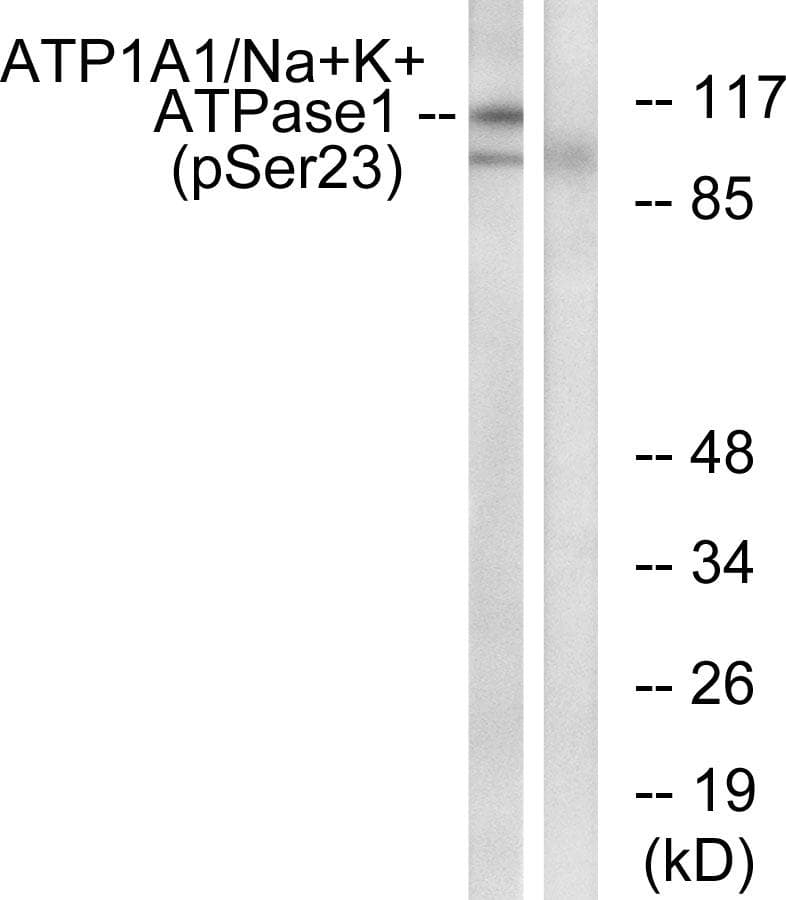 ATP1A1 Antibody (phospho-Ser23)