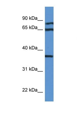 DHPS Antibody (aa51-100)