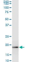 ICT1 / DS1 Antibody (clone 6F8)