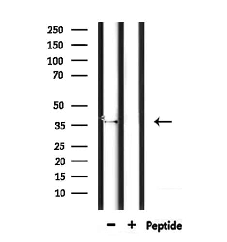 OR4D5 Antibody