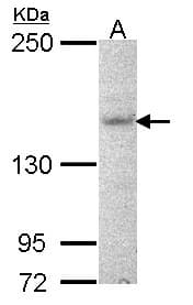 IHC-plus™ AHI1 Antibody (aa1-42)