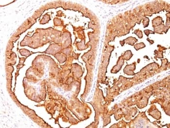 EMA / MUC1 Antibody (clone E29, Ready-to-Use)