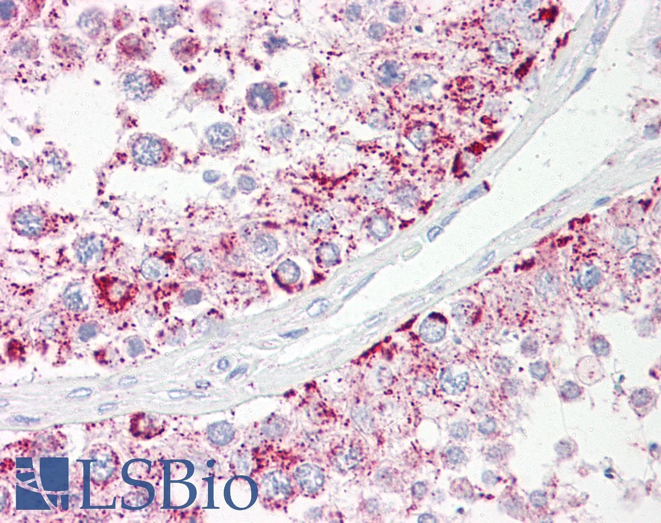 IHC-plus™ Polyclonal Rabbit anti-Human ABHD4 Antibody (aa251-300, IHC)