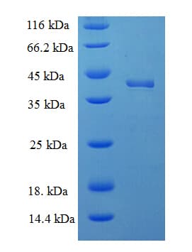 Human DOK5 Protein (Recombinant His-SUMO)